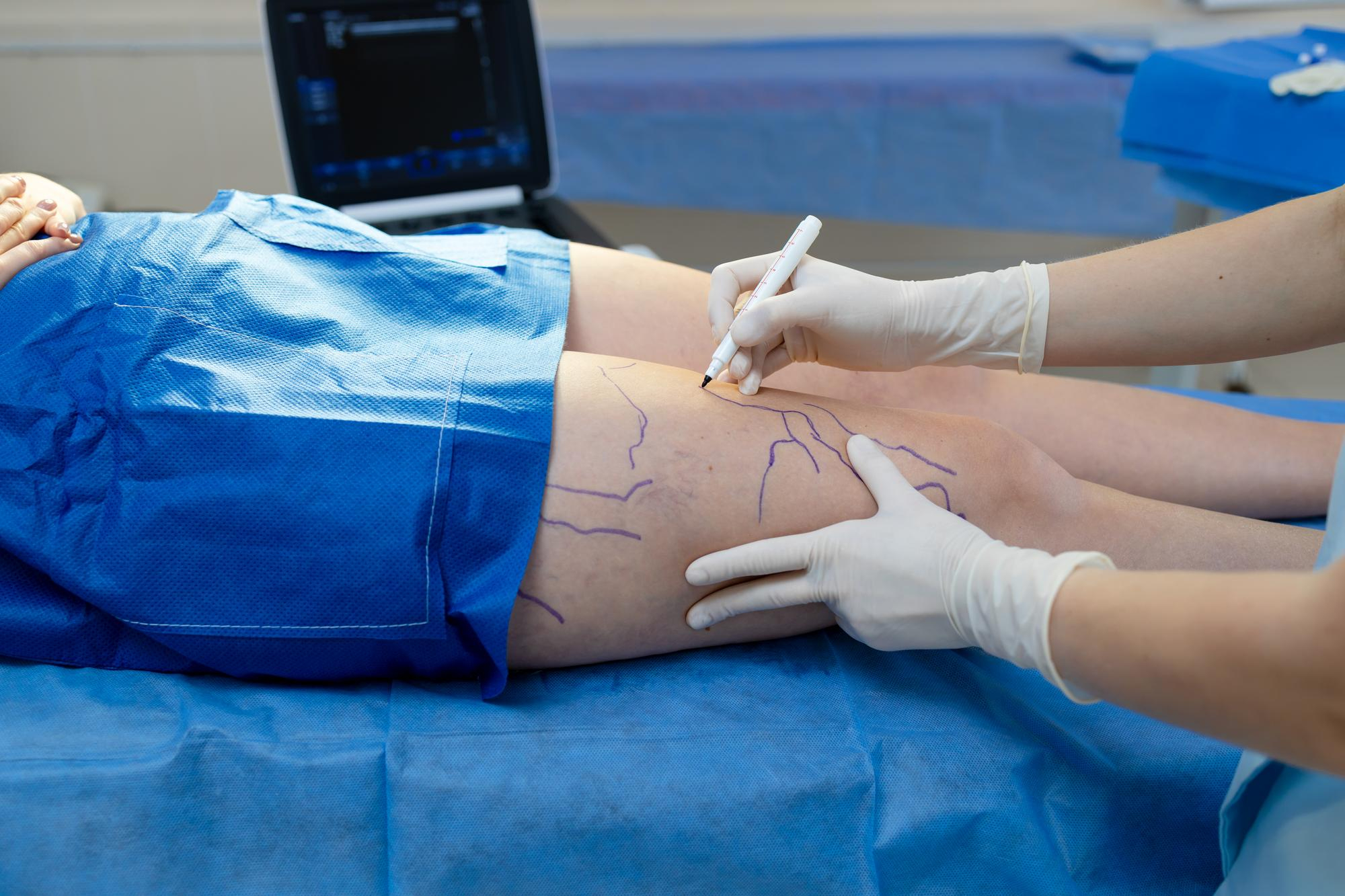 Cirurgia Vascular